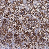 Anti-SCARB1 Prestige Antibodies&#174; Powered by Atlas Antibodies, affinity isolated antibody