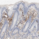 Anti-VCAN antibody produced in rabbit Prestige Antibodies&#174; Powered by Atlas Antibodies, affinity isolated antibody, buffered aqueous glycerol solution
