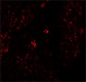 Anti-HMMR antibody produced in rabbit affinity isolated antibody