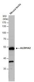 Anti-ALDH1A2 antibody produced in rabbit affinity isolated antibody, buffered aqueous solution