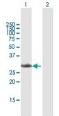 Anti-CCND3 antibody produced in mouse IgG fraction of antiserum, buffered aqueous solution
