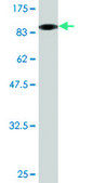 Monoclonal Anti-VCL antibody produced in mouse clone 3F8-1D4, purified immunoglobulin, buffered aqueous solution