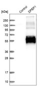 Anti-DPEP1 antibody produced in rabbit Prestige Antibodies&#174; Powered by Atlas Antibodies, affinity isolated antibody, buffered aqueous glycerol solution