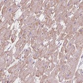 Anti-POPDC2 antibody produced in rabbit Prestige Antibodies&#174; Powered by Atlas Antibodies, affinity isolated antibody, buffered aqueous glycerol solution