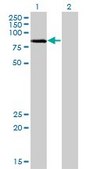 Monoclonal Anti-LIMK2 antibody produced in mouse clone 2H2-E11, purified immunoglobulin, buffered aqueous solution