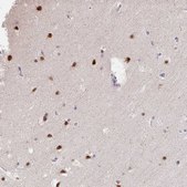 Anti-GTF2H1 antibody produced in rabbit Prestige Antibodies&#174; Powered by Atlas Antibodies, affinity isolated antibody, buffered aqueous glycerol solution