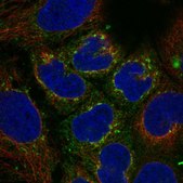 Anti-VTN antibody produced in rabbit Prestige Antibodies&#174; Powered by Atlas Antibodies, affinity isolated antibody, buffered aqueous glycerol solution
