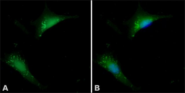 Anti-Cofilin antibody produced in rabbit IgG fraction of antiserum, buffered aqueous solution