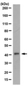 Anti-SERPINB5 Antibody, clone 5C6.2 clone 5C6.2, from mouse