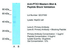 Anti-PTX3 antibody produced in rabbit affinity isolated antibody