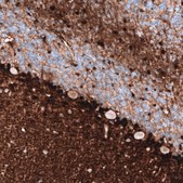 Monoclonal Anti-S100B antibody produced in mouse Prestige Antibodies&#174; Powered by Atlas Antibodies, clone CL2720, purified immunoglobulin, buffered aqueous glycerol solution