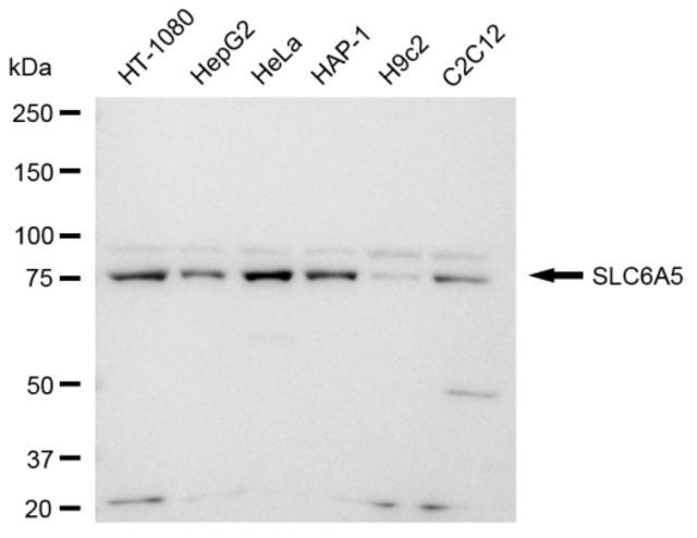 Anti SLC6A5 Antibody, clone 23GB4145, Rabbit Monoclonal clone 23GB4145, recombinant rabbit monoclonal, expressed in HEK293 cells