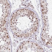 Anti-PTPN2 antibody produced in rabbit Prestige Antibodies&#174; Powered by Atlas Antibodies, affinity isolated antibody, buffered aqueous glycerol solution