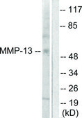 Anti-MMP-13 antibody produced in rabbit affinity isolated antibody