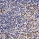Anti-TLR8 antibody produced in rabbit Prestige Antibodies&#174; Powered by Atlas Antibodies, affinity isolated antibody, buffered aqueous glycerol solution