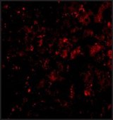 Anti-DRAM (ab2) antibody produced in rabbit affinity isolated antibody, buffered aqueous solution