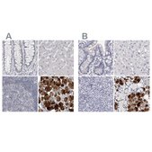 Anti-CA6 antibody produced in rabbit Prestige Antibodies® Powered by Atlas Antibodies, affinity isolated antibody, buffered aqueous glycerol solution, ab2