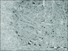 Anti-Granulin (C-terminal) antibody produced in rabbit ~1.0&#160;mg/mL, affinity isolated antibody