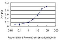 Monoclonal Anti-ULK4 antibody produced in mouse clone 4A10-1A7, purified immunoglobulin, buffered aqueous solution