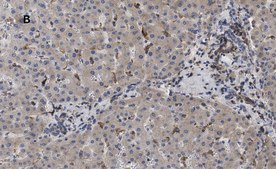 Anti-LDL Receptor Antibody, clone 2N19, ZooMAb&#174; Rabbit Monoclonal recombinant, expressed in HEK 293 cells