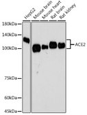 Anti-ACE2 Antibody, clone 5X5W10, Rabbit Monoclonal