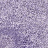 Anti-CYP11B1 antibody produced in rabbit Prestige Antibodies&#174; Powered by Atlas Antibodies, affinity isolated antibody, buffered aqueous glycerol solution