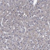 Anti-DTNBP1 antibody produced in rabbit Prestige Antibodies&#174; Powered by Atlas Antibodies, affinity isolated antibody, buffered aqueous glycerol solution