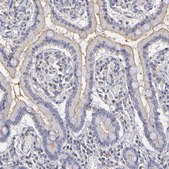 Anti-ABCB1 antibody produced in rabbit Prestige Antibodies&#174; Powered by Atlas Antibodies, affinity isolated antibody, buffered aqueous glycerol solution