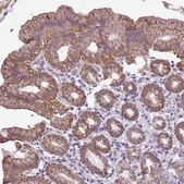 Anti-ALDH2 antibody produced in rabbit Prestige Antibodies&#174; Powered by Atlas Antibodies, affinity isolated antibody, buffered aqueous glycerol solution