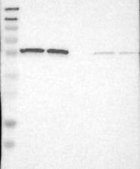 Anti-PSMC1 antibody produced in rabbit Prestige Antibodies&#174; Powered by Atlas Antibodies, affinity isolated antibody, buffered aqueous glycerol solution