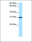 Anti-PRDX3 antibody produced in rabbit affinity isolated antibody