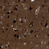 Anti-NUDCD3 antibody produced in rabbit Prestige Antibodies&#174; Powered by Atlas Antibodies, affinity isolated antibody, buffered aqueous glycerol solution, Ab1