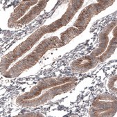 Monoclonal Anti-ATG5 antibody produced in mouse Prestige Antibodies&#174; Powered by Atlas Antibodies, clone CL9508, purified immunoglobulin, buffered aqueous glycerol solution