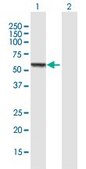 Anti-CCM2 antibody produced in mouse IgG fraction of antiserum, buffered aqueous solution