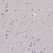 Anti-P2RY10 antibody produced in rabbit Prestige Antibodies® Powered by Atlas Antibodies, affinity isolated antibody