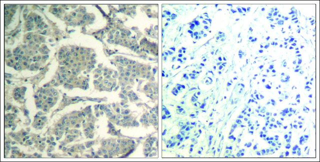 Anti-CCFL1/CFL2 (Ab-88) antibody produced in rabbit affinity isolated antibody