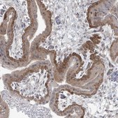 Anti-PPAT antibody produced in rabbit Prestige Antibodies&#174; Powered by Atlas Antibodies, affinity isolated antibody, buffered aqueous glycerol solution