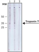 Monoclonal Anti-Troponin T antibody produced in mouse clone JLT-12, ascites fluid