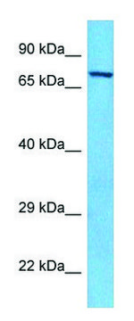 Anti-PAK6 (C-terminal) antibody produced in rabbit affinity isolated antibody