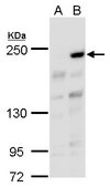 Anti-ARID2 antibody produced in rabbit affinity isolated antibody