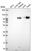 Anti-VCAM1 antibody produced in rabbit Prestige Antibodies&#174; Powered by Atlas Antibodies, affinity isolated antibody