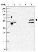 Anti-TRIM32 antibody produced in rabbit Prestige Antibodies&#174; Powered by Atlas Antibodies, affinity isolated antibody, buffered aqueous glycerol solution