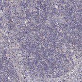 Anti-DDC antibody produced in rabbit Prestige Antibodies&#174; Powered by Atlas Antibodies, affinity isolated antibody, buffered aqueous glycerol solution