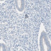 Anti-ART3 antibody produced in rabbit Prestige Antibodies&#174; Powered by Atlas Antibodies, affinity isolated antibody, buffered aqueous glycerol solution