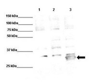 Anti-PORCN antibody produced in rabbit affinity isolated antibody