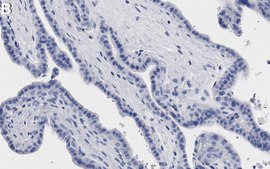 Anti-IGF-2R/CD222 Antibody, clone 2O9 ZooMAb&#174; Rabbit Monoclonal recombinant, expressed in HEK 293 cells