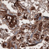 Monoclonal Anti-FN1 antibody produced in mouse Prestige Antibodies&#174; Powered by Atlas Antibodies, clone CL3730, purified immunoglobulin, buffered aqueous glycerol solution