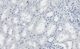 Anti-PDHA1 Antibody, clone 1B13 ZooMAb&#174; Rabbit Monoclonal recombinant, expressed in HEK 293 cells