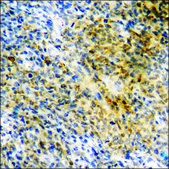 Anti-phospho-SYK (pTyr348) antibody produced in rabbit affinity isolated antibody