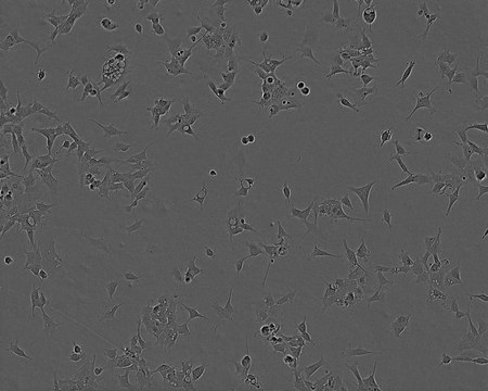 293 Cell Line human NOTE: Both the cell line and DNA from the cell line may be available for this product. Please choose -1VL or VIAL for cells, or -DNA-5UG for DNA, 85120602, human kidney (embryonic), Epithelial